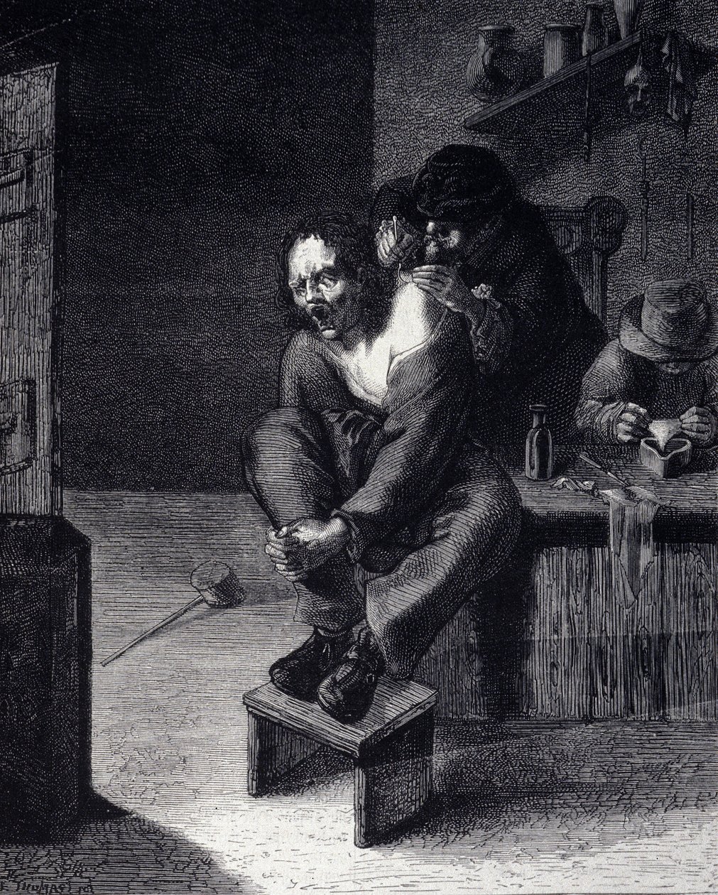 Kirurginen leikkaus Kaiverrus Adrien Brauwerin maalauksen jälkeen (1608) 1600-luku tekijältä Adriaen (after) Brouwer