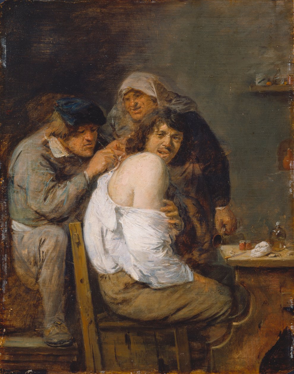 Selkäoperaatio, noin 1636 (öljy puulle) tekijältä Adriaen Brouwer