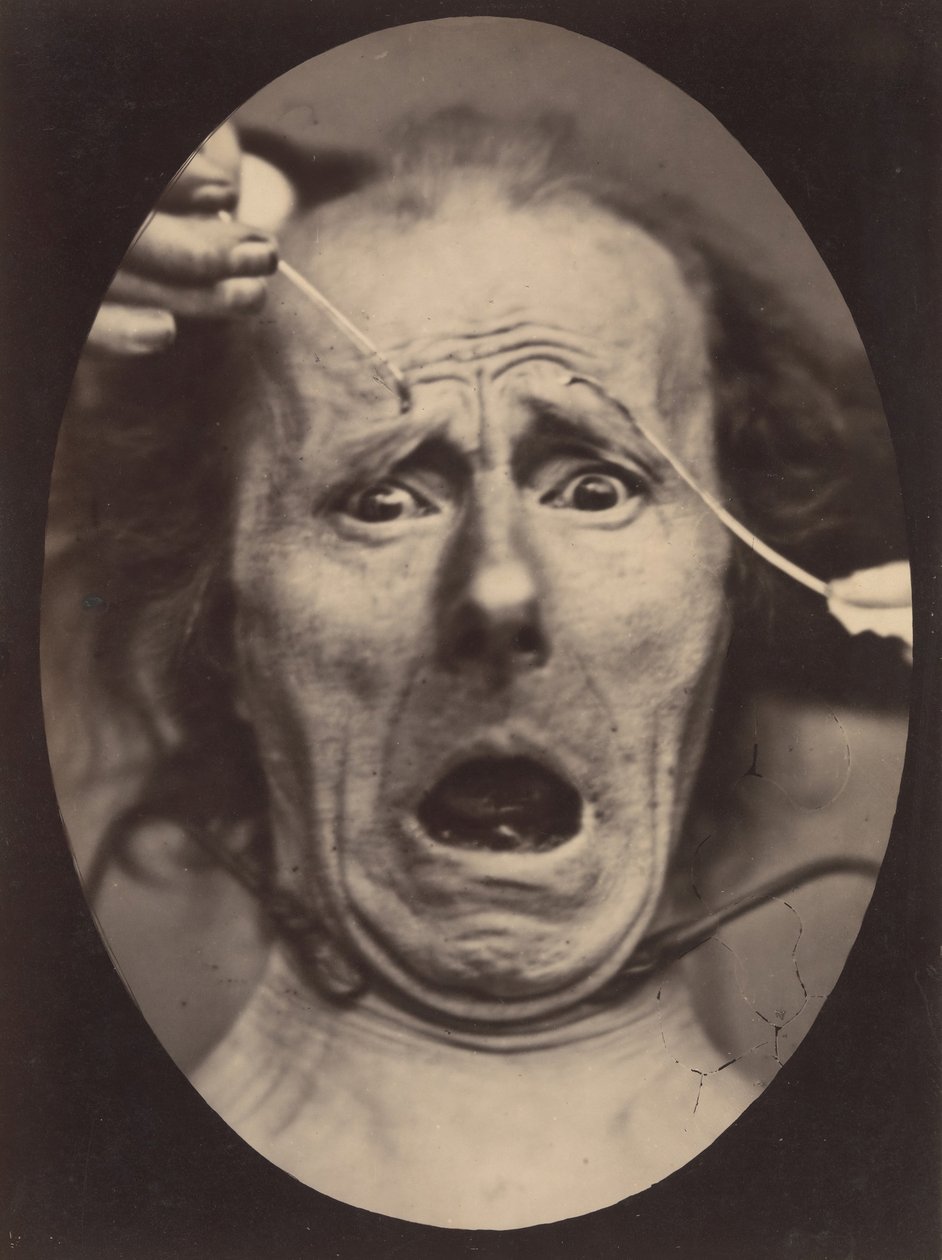 Electro-Physiologie, kuva 64, 1854-56, painettu 1862. tekijältä Adrien Alban Tournachon