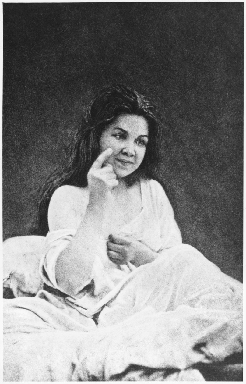 Kuulohallusinaatiot, Desire Magloire Bournevillen (1840-1909) ja Paul Regnardin (1850-1927) teoksesta "Iconographie de la Salpetriere" 1878 tekijältä Albert Londe