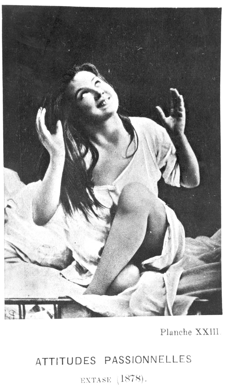 Intohimoiset asenteet: Augustine innostunut, Desire Magloire Bournevillen (1840-1909) ja Paul Regnardin (1850-1927) teoksesta Iconographie de la Salpetriere, 1878 tekijältä Albert Londe