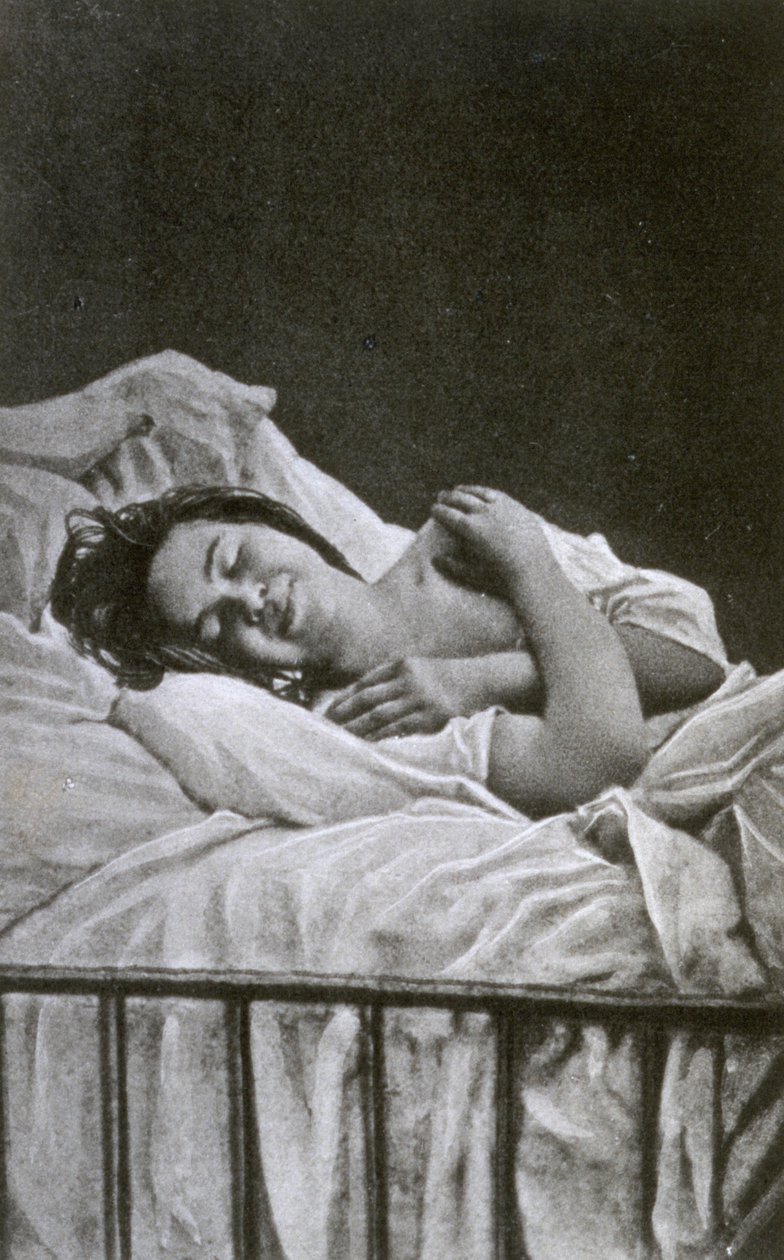 Nuori nainen, jolla on hysteriakohtaus, 1878 tekijältä Albert Londe