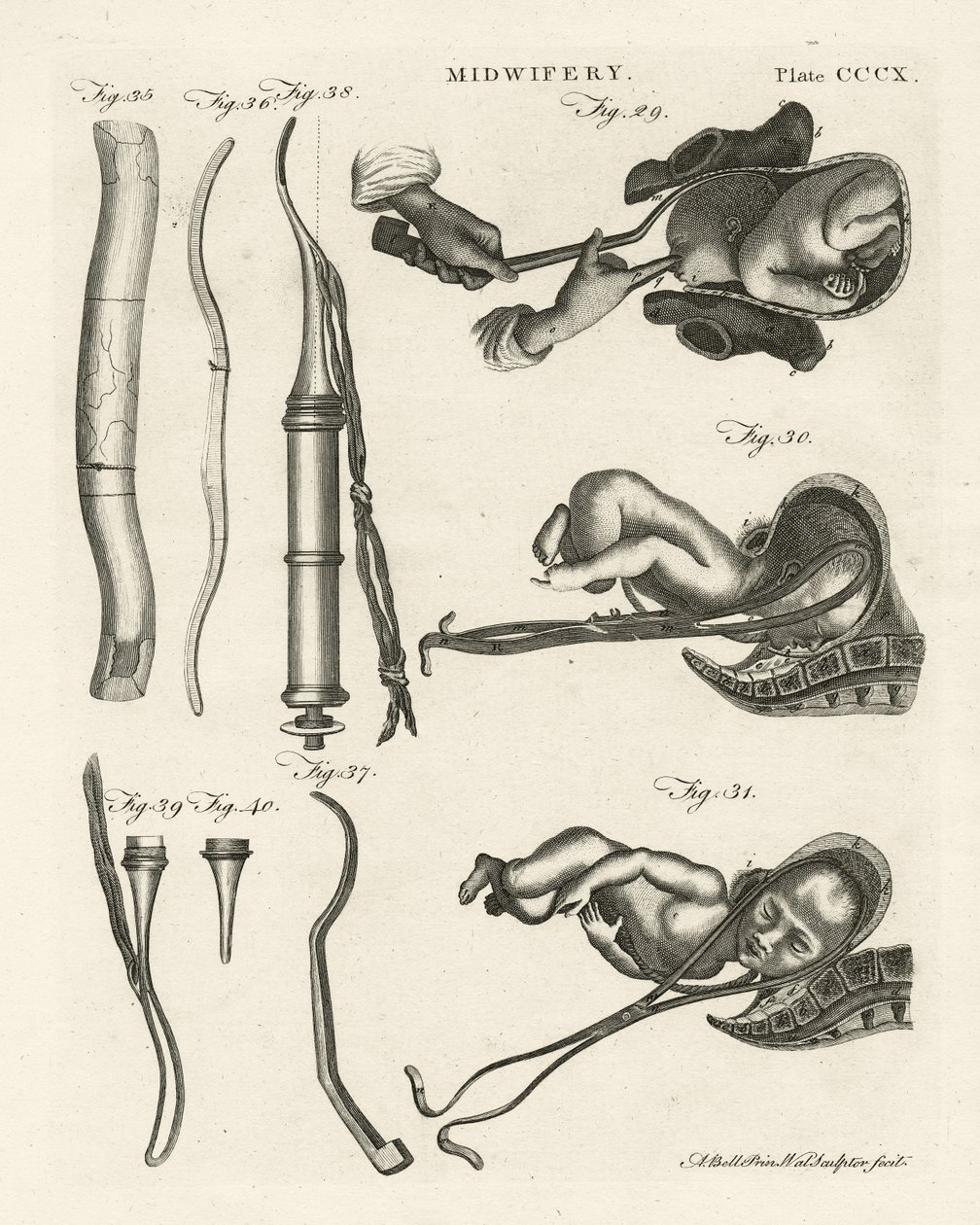 Kätilötyö, kuvitus Encyclopedia Britannicasta, julkaistu Edinburghissa, 1798 (kuparikaiverrus) tekijältä Alexander Bell