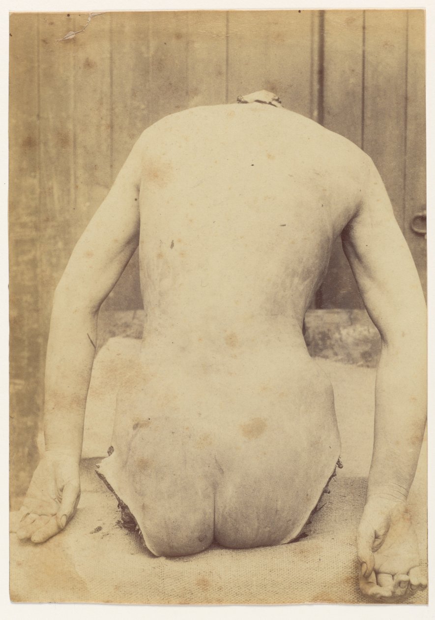 Rungon takaosa tekijältä Alphonse Bertillon