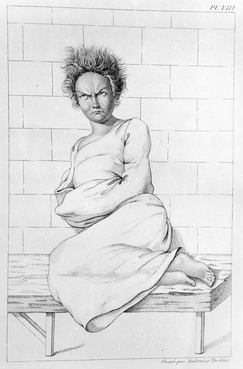 Nainen pakkopaidassa, kuvitus teokselle "Des Maladies Mentales, jota tarkastellaan lääketieteellisen, hygienian ja lääketieteellisen oikeudellisen raportin alla", kirjoittanut Etienne Esquirol (1772-1840), 1838 tekijältä Ambroise Tardieu