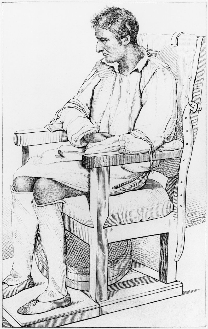 Dementia, kuva Etienne Esquirolin (1772-1840) 1838 julkaisusta "Des Maladies Mentales, joka on otettu huomioon lääketieteellisessä, hygieenisessä ja lääketieteellisessä oikeudessa" tekijältä Ambroise Tardieu
