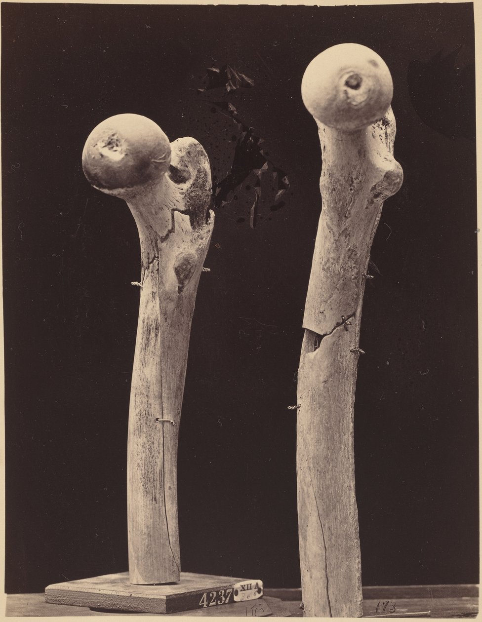 Näytteet reisiluun ampumamurtumista,c. 1867 (kuva) tekijältä American Photographer