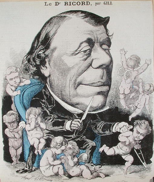 Tohtori Philippe Ricordin (1800-89) karikatyyri (värillinen kaiverrus) tekijältä Andre Gill