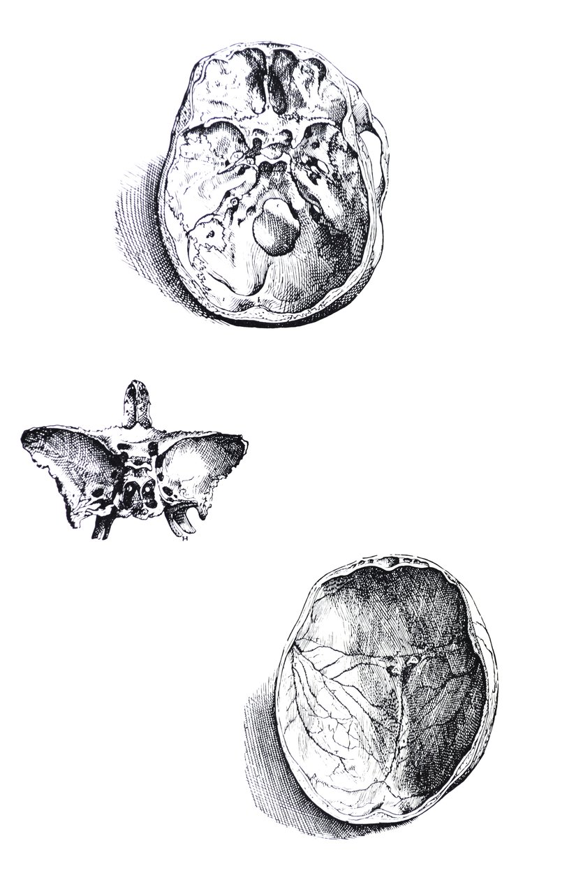 De Humani Corporis Fabrica -teoksen ensimmäisen kirjan laatat tekijältä Andreas Vesalius