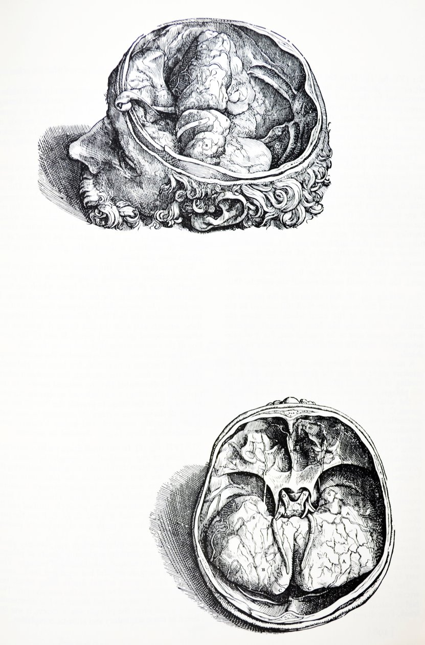 Lautaset De Humani Corporis Fabrican seitsemännestä kirjasta tekijältä Andreas Vesalius