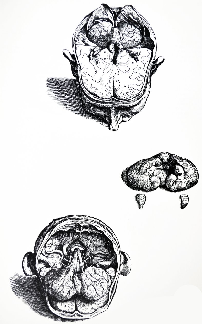 Lautaset De Humani Corporis Fabrican seitsemännestä kirjasta tekijältä Andreas Vesalius
