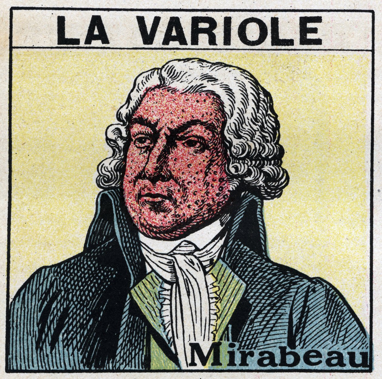 Honore Gabriel (Honore-Gabriel) Riquetin, Mirabeaun kreivin (1749-1791) muotokuva, jossa kasvot isorokkoa sairastavat. Isorokon aiheuttamien arpien välttämiseksi potilaita tulee hoitaa huoneissa tai mennä vain punaiseen valoon, jossa ei ole ultraviolettisä tekijältä Anonymous Anonymous