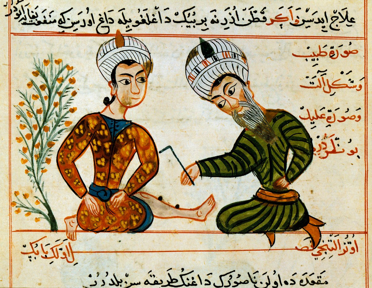 Haavan polttaminen. Miniatyyri arabialaisen lääketieteen lypsämisestä. 1400-luvun Pariisi, B.N. tekijältä Arabic School