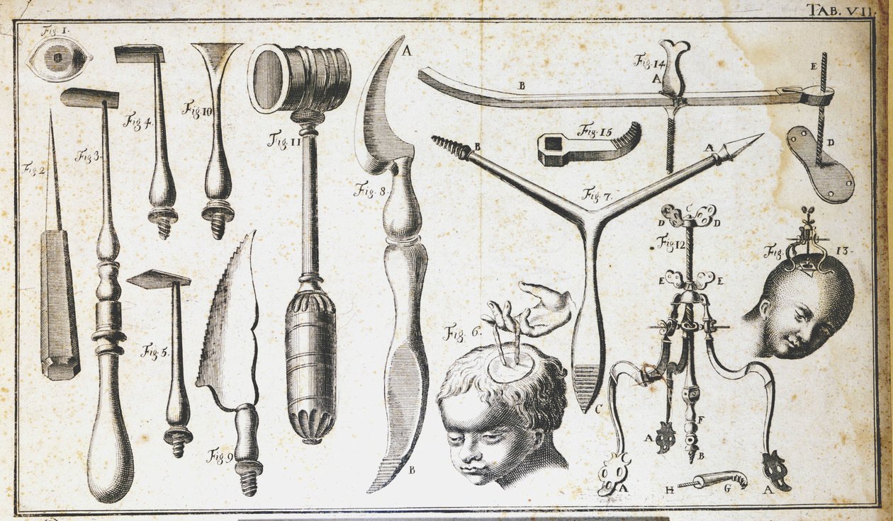 Kirurginen lauta, joka edustaa erilaisia kirurgisia instrumentteja, vasaraa, kampasimpukkaa, veitsiä, aivojen poistoon. Kaiverrus Benoit Louis Prevost (1735-1809) 1700-luku tekijältä Benoit Louis Prevost