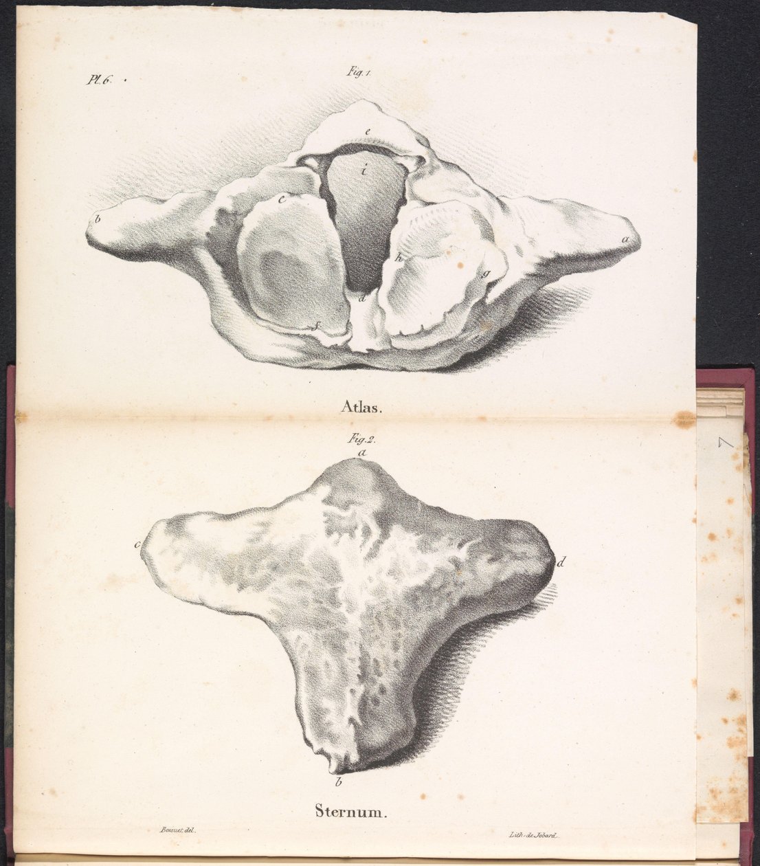 Valaan atlas ja rintalastan, 1827 Atlas / Rintalasta (otsikko esineessä) tekijältä Bossuet