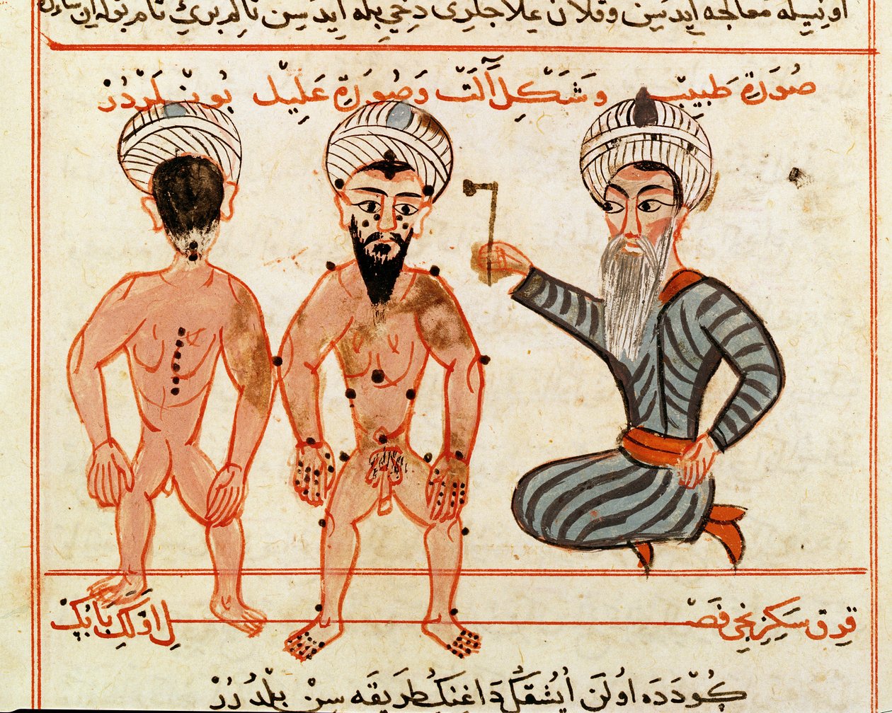 Ms Sup Turc 693 fol.46v Lepravaurioiden kauterisaatio, 1466 tekijältä Charaf ed Din