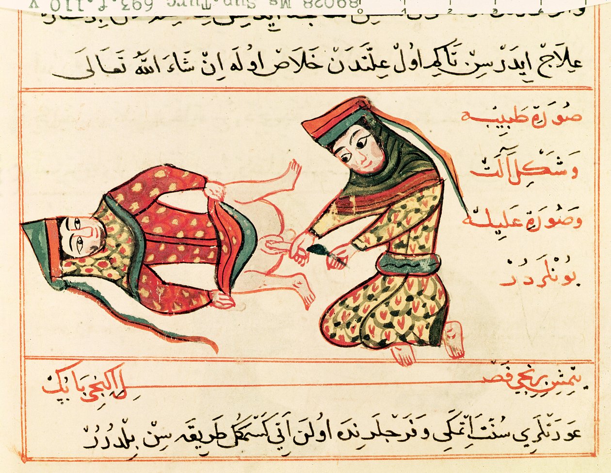 Ms Sup Turc 693 fol.110v Kätilö, joka toimii hermafrodiitilla, 1466 tekijältä Charaf ed Din