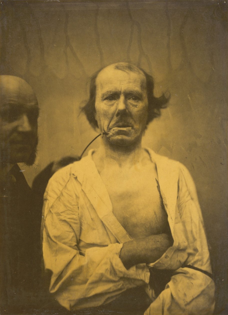 Rento ilme vasemmalla, Inho oikealla, 1854-1856, painettu 1862. tekijältä Duchenne de Boulogne
