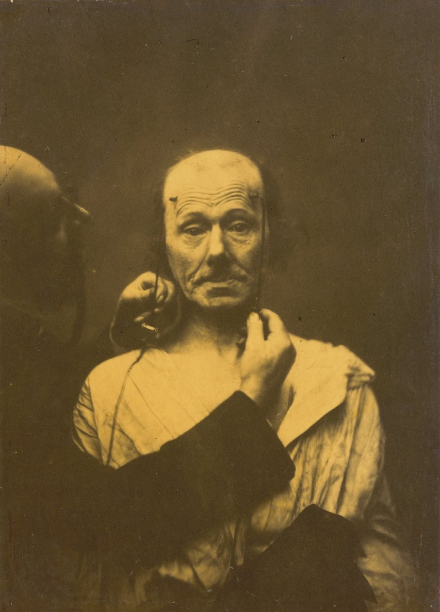 Huomio, 1854-1856, painettu 1862. tekijältä Duchenne de Boulogne