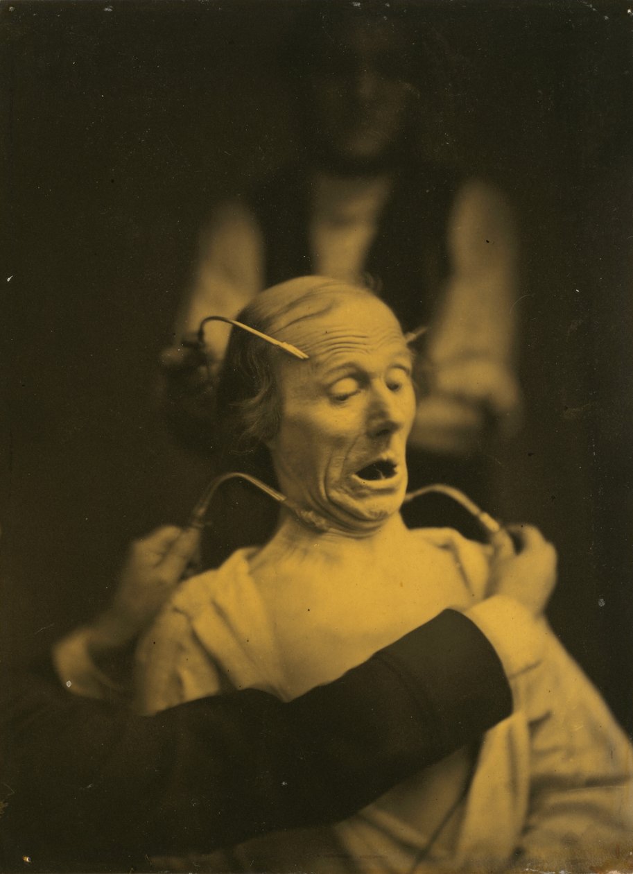 Kauhuilmaisu, 1854-1856, painettu 1862. tekijältä Duchenne de Boulogne
