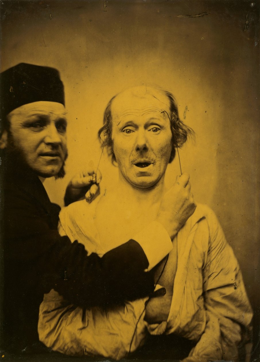 Yllätys, 1854-1855, painettu 1862. tekijältä Duchenne de Boulogne