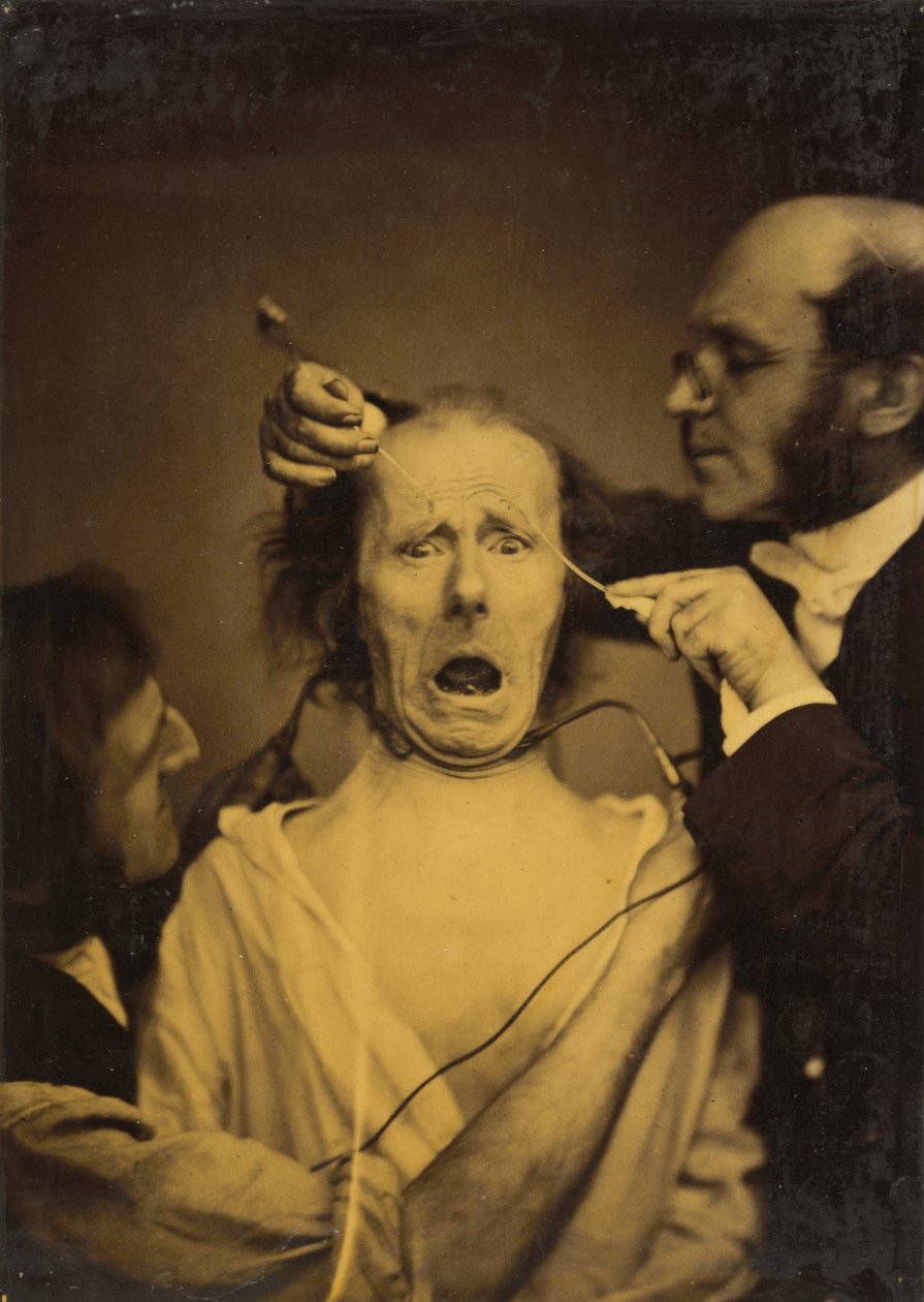 Terror sekoitettuna kipuun, kidutukseen, 1854-1856, painettu 1862. tekijältä Duchenne de Boulogne