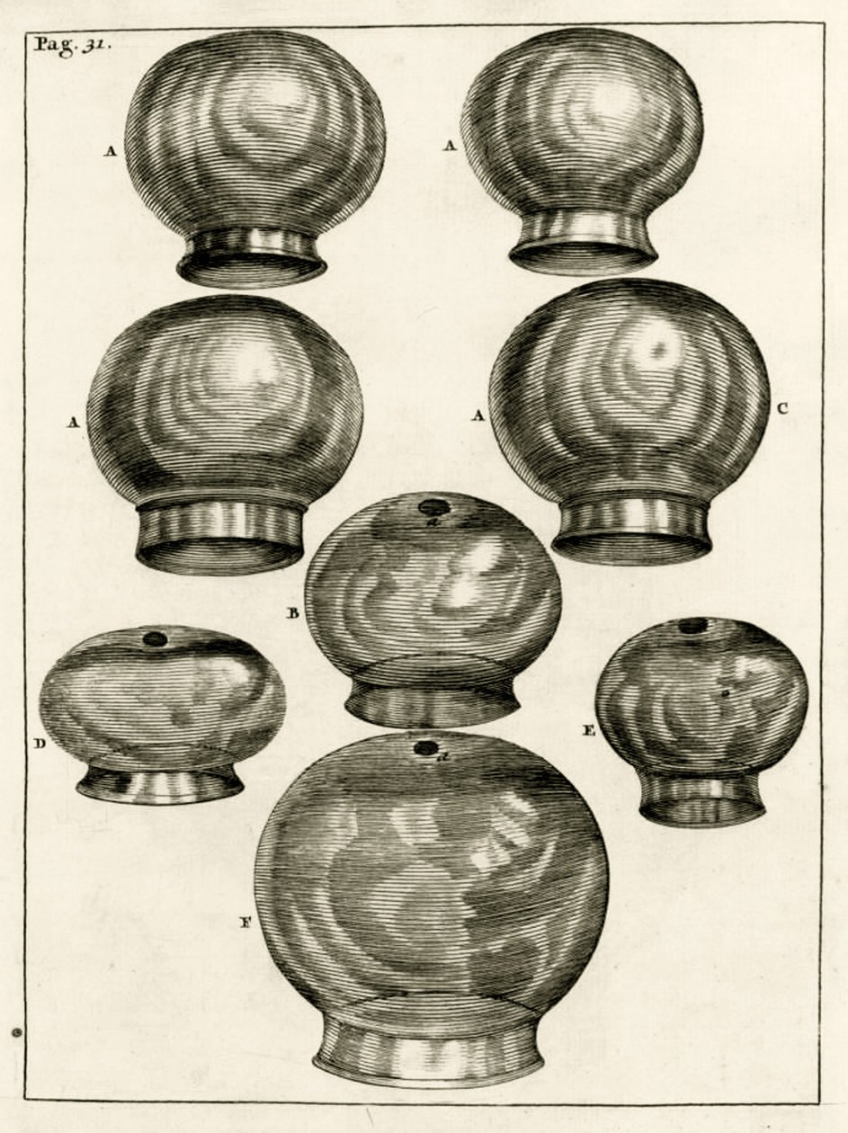 Erilaisia ​​kuppilasit, Frederik Dekkersin The Practice of Medicine, 1694 tekijältä Dutch School