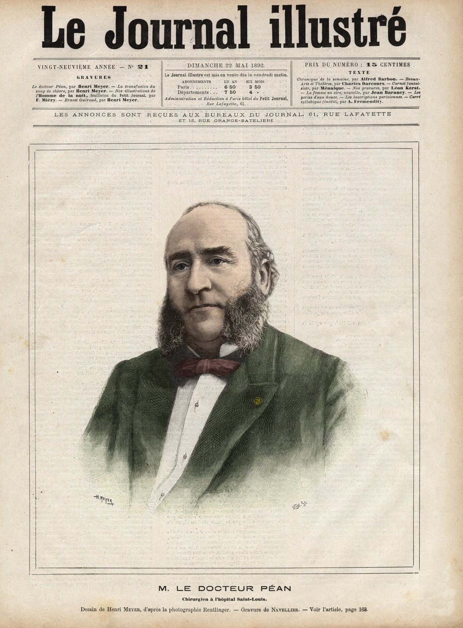 Muotokuva Jules Emile (Jules-Emile) Pean (1830-1898), ranskalainen kirurgi - Navellierin kaiverrus "Kuvallinen päiväkirja" vuodelta 1892 tekijältä Edouard Felicien Eugene Navellier