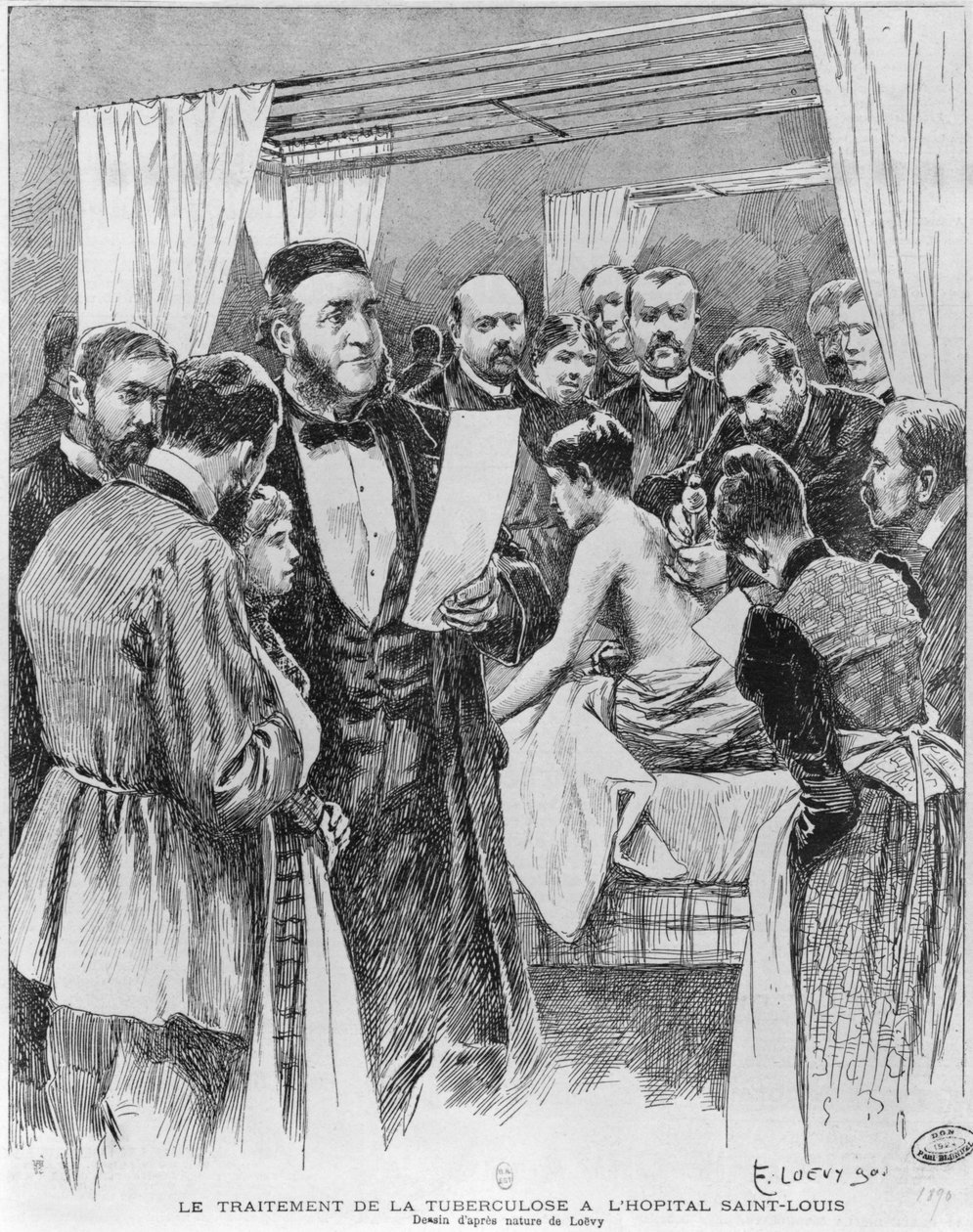 Tuberkuloosin hoito St. Louisin sairaalassa, Pariisissa, 1890 tekijältä Edward Loevy