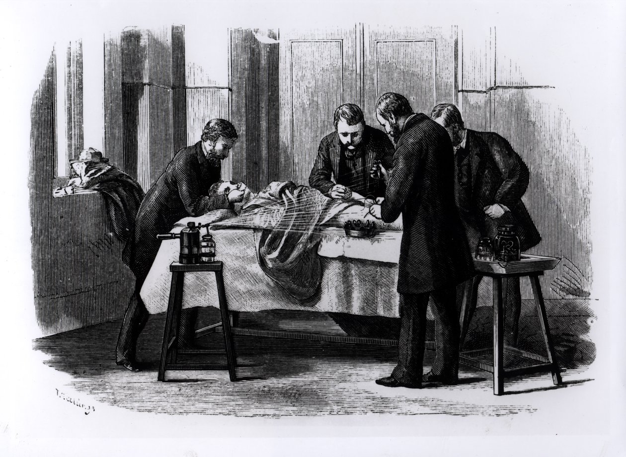 Antiseptinen kirurgia, 1882 tekijältä English School