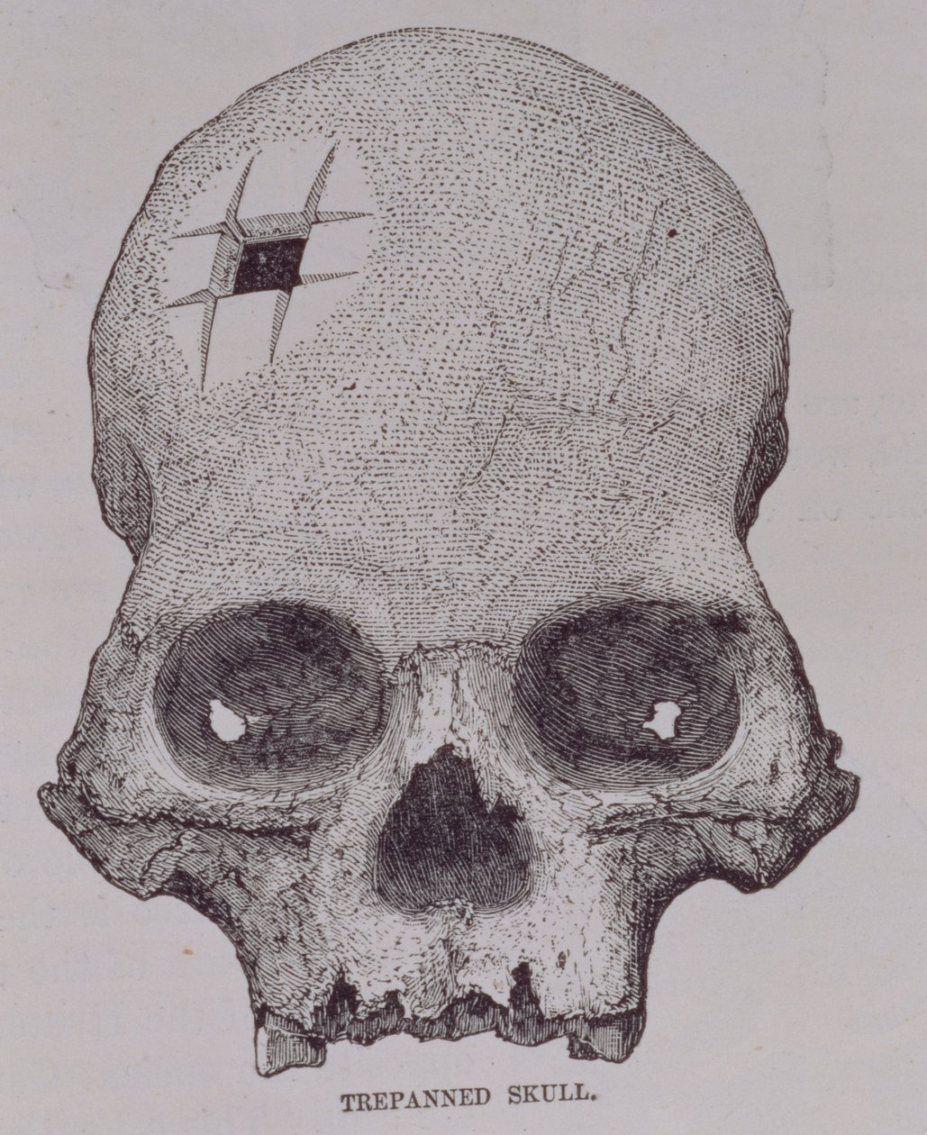Trepanned Skull, E. George Squierin "Incidents of Travel and Exploration in the Land of the Incas", pub. vuonna 1878 tekijältä English School