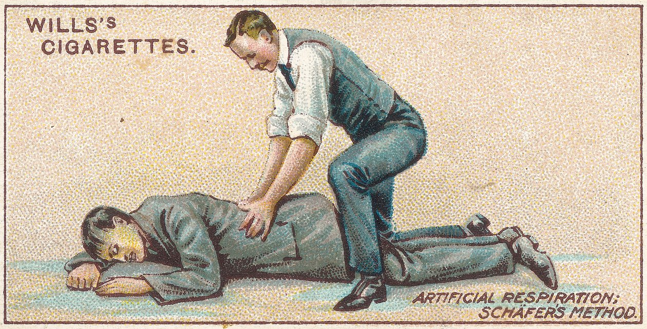 Keinotekoinen hengitys, Schafersin menetelmä, nro 25 Willss Cigarettes -korttien First Aid -sarjasta, 1913 tekijältä English School
