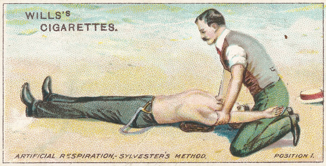 Keinotekoinen hengitys, Sylvestersin menetelmä - Asento 1, nro 17 Willss-savukekorttien First Aid -sarjasta, 1913 tekijältä English School