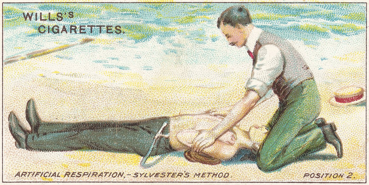 Keinotekoinen hengitys, Sylvester