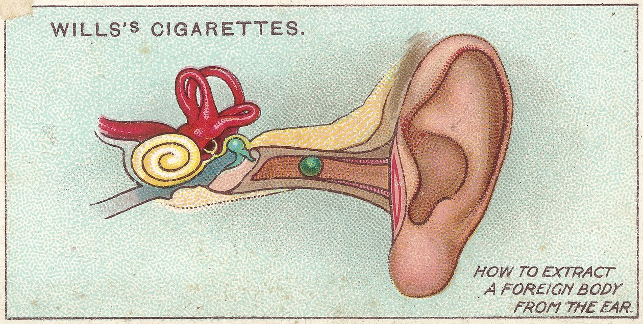 Vieras kappale korvassa, no. 30 Willss-savukekorttien First Aid -sarjasta, 1913 tekijältä English School