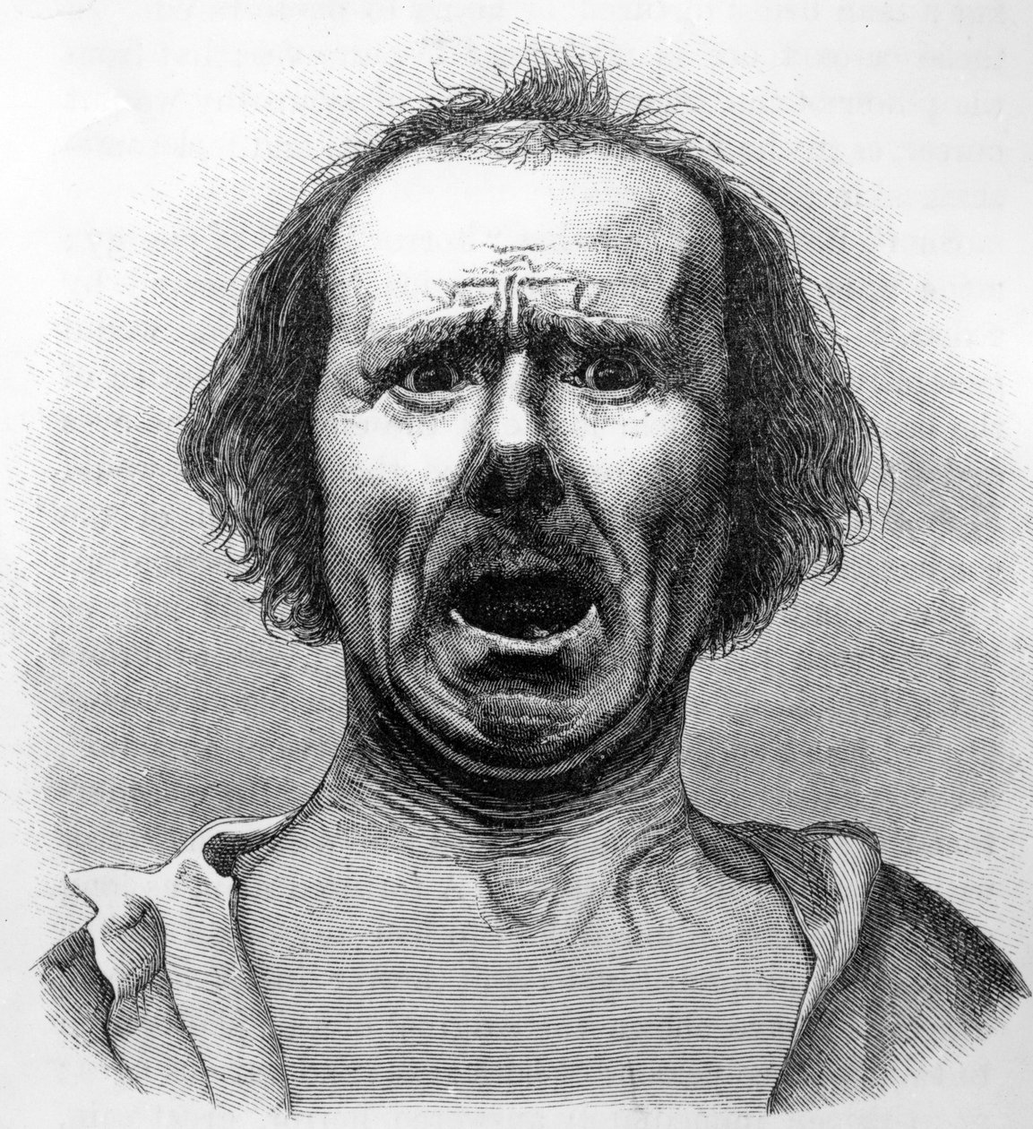 Kauhu ja tuska, kopioitu tohtori Duchennen valokuvasta, kuvitus Charles Darwinin teoksesta "The Expression of the Emotions in Man and Animals", julkaistu 1872 tekijältä English School