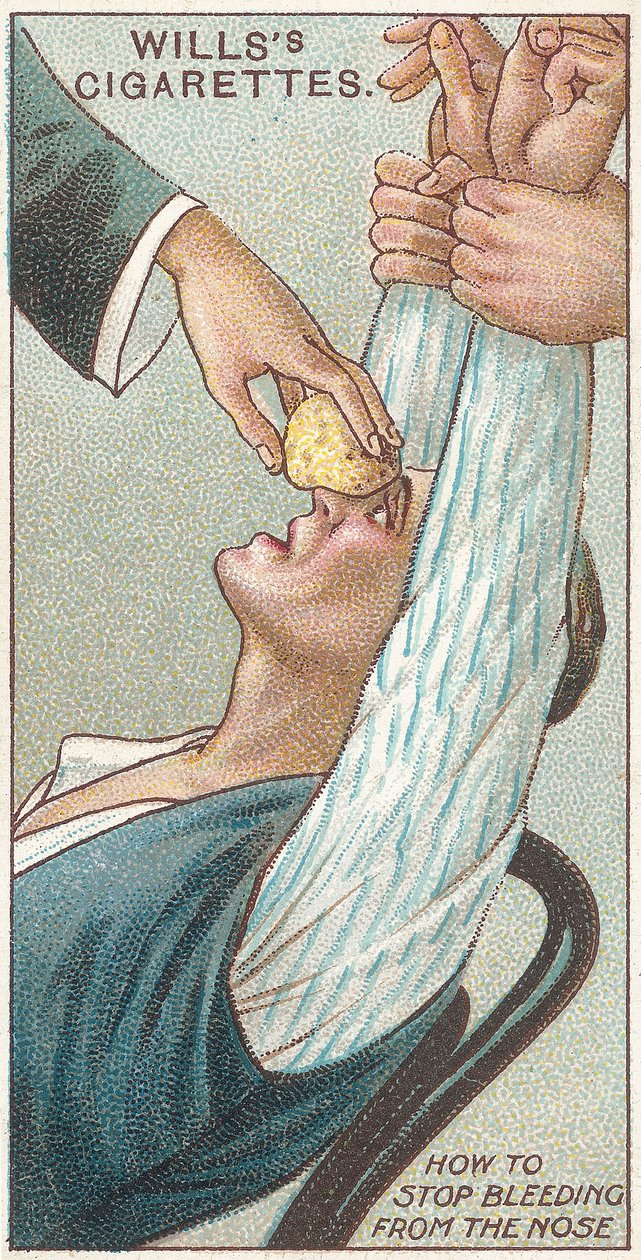 Kuinka lopettaa verenvuoto nenästä, nro 31 Willss-savukekorttien First Aid -sarjasta, 1913 tekijältä English School