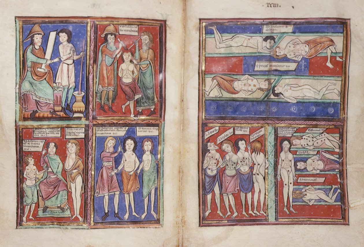 Sloane 1975 fol.91v-92 Lääketieteelliset kohtaukset tekijältä English School