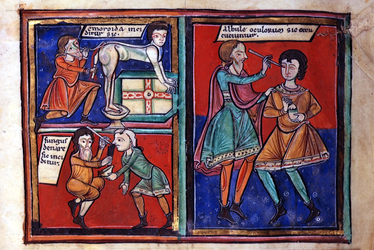 Sloane Ms 1975 fol.93 Lääketieteelliset leikkaukset tekijältä English School