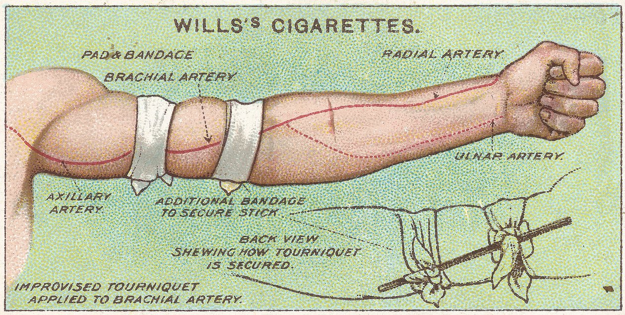 Tourniquet, nro 11 Willss-savukekorttien First Aid -sarjasta, 1913 tekijältä English School