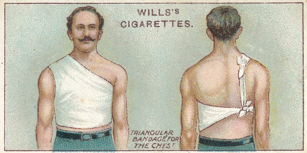Kolmikulmainen side rintakehään, nro. 37 Willss Cigarettes -korttien First Aid -sarjasta, 1913 tekijältä English School