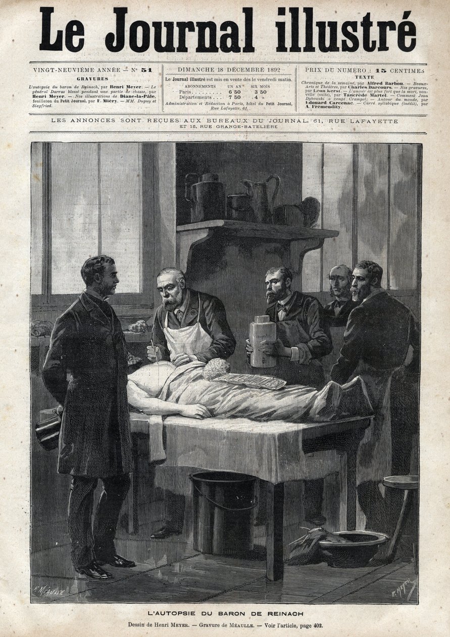 Paroni Jacques de Reinachin (1840-1892) ruumiinavaus vuonna 1892 - Meaullen kaiverrus "The Illustrous Journal" -julkaisussa 1892 tekijältä Fortune Louis Meaulle