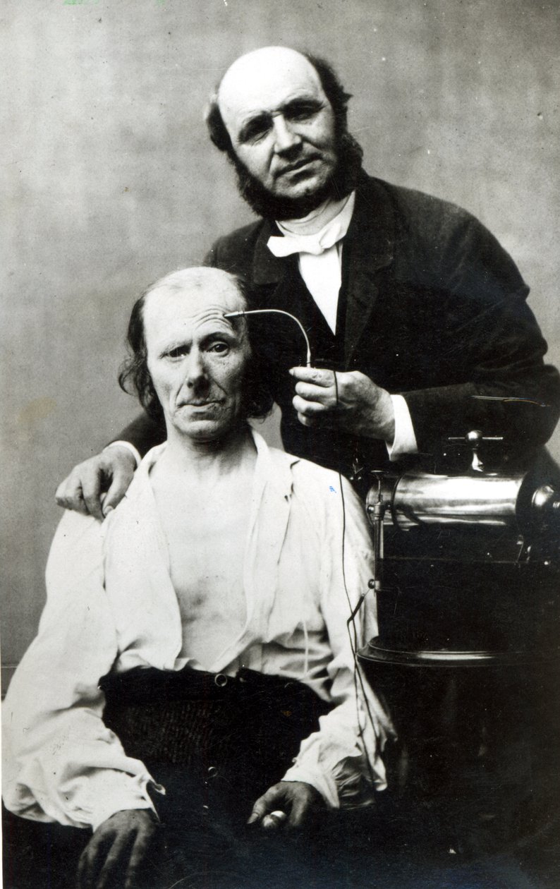 Duchenne de Boulogne uhriksi joutuneen potilaan kanssa, 1862 tekijältä French Photographer