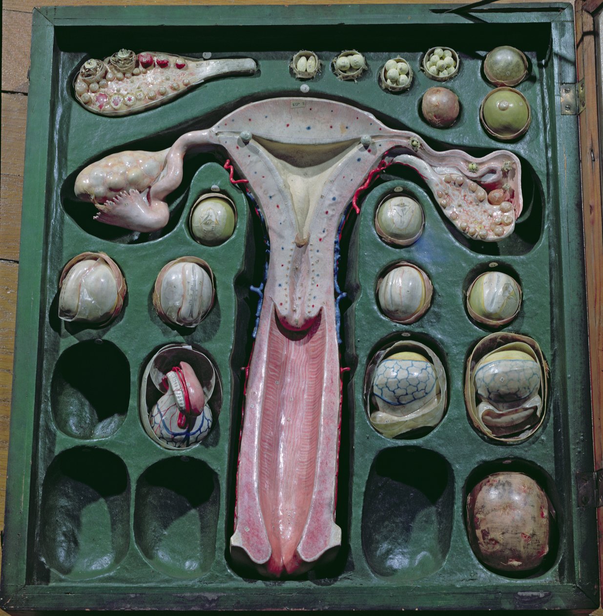 Naisten sukuelimet, c. 1830 (maalattu pahvi) tekijältä French School