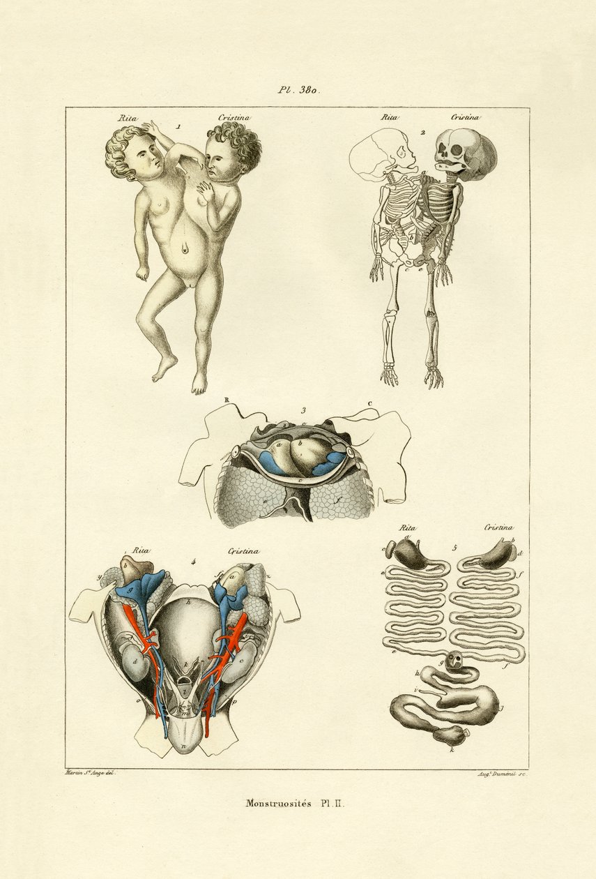 Freak, 1833-39 tekijältä French School