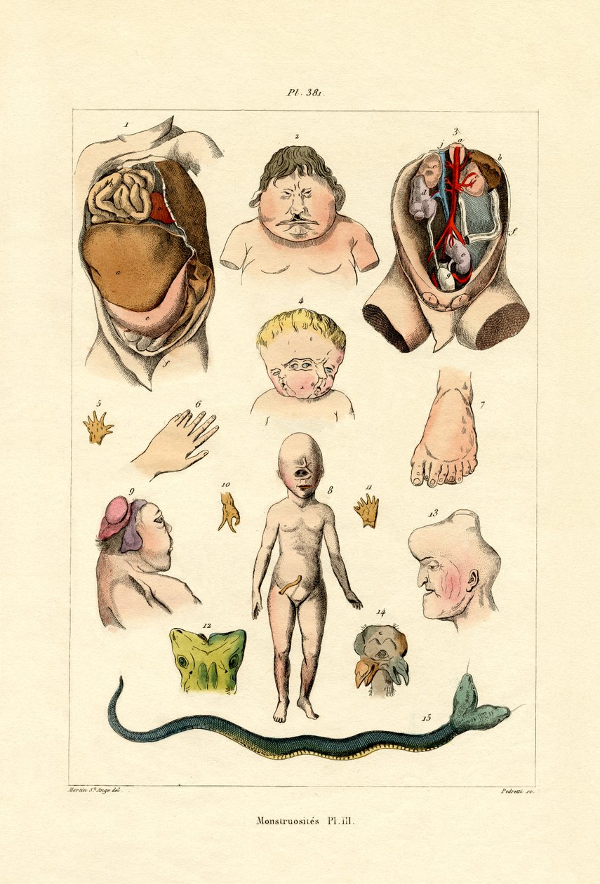Freak, 1833-39 tekijältä French School