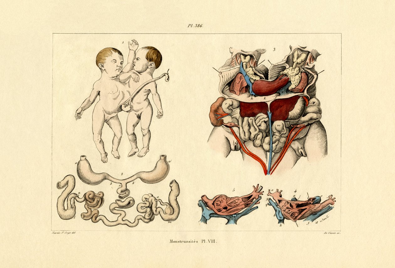Freak, 1833-39 tekijältä French School