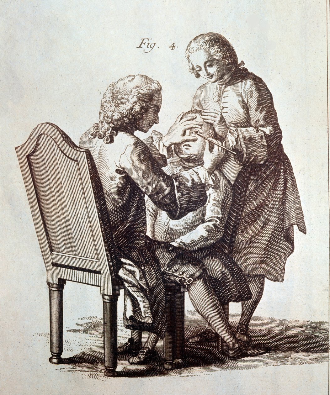 Lääkäri leikkaa kaihipotilasta, kuva Denis Diderot