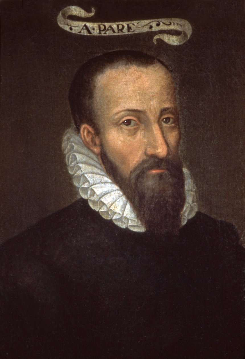 Ambroise Pare. 1500-luku (maalaus) tekijältä French School