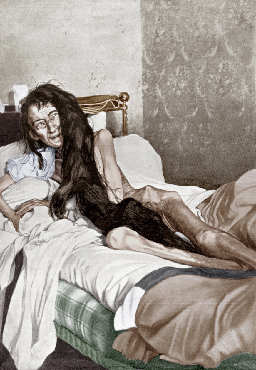 Blanche Monnier sairaalassa, Poitiers, kesäkuu 1901 (printti). tekijältä French School